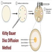 Kirby-Bauer-Disc-Diffusion-Method-For-Antibiotic-Susceptibility-Testing